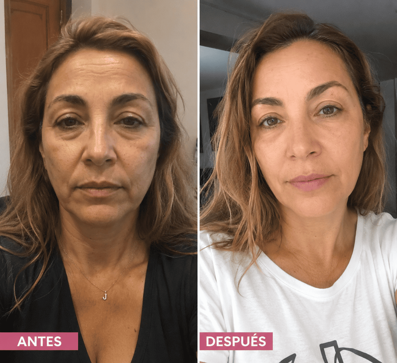 NIDA: Piel Más Firme, Suave y Radiante Cada Día